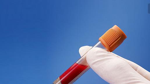 健康體檢一般檢查哪些項目? 健康體檢一般檢查哪些項目?